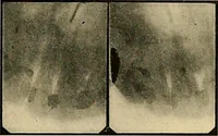 An illustration from The Roentgen rays in medicine and surgery as an aid in diagnosis and as a therapeutic agent : designed for the use of practitioners and students (1901)