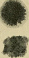 An illustration from The Roentgen rays in medicine and surgery as an aid in diagnosis and as a therapeutic agent : designed for the use of practitioners and students (1901)