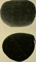 An illustration from The Roentgen rays in medicine and surgery as an aid in diagnosis and as a therapeutic agent : designed for the use of practitioners and students (1901)