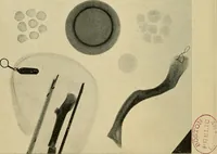 An illustration from The Roentgen rays in medicine and surgery as an aid in diagnosis and as a therapeutic agent : designed for the use of practitioners and students (1901)