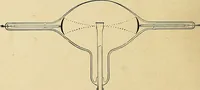 An illustration from The Roentgen rays in medicine and surgery as an aid in diagnosis and as a therapeutic agent : designed for the use of practitioners and students (1901)
