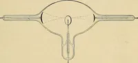 An illustration from The Roentgen rays in medicine and surgery as an aid in diagnosis and as a therapeutic agent : designed for the use of practitioners and students (1901)