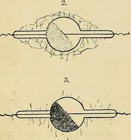 An illustration from The Roentgen rays in medicine and surgery as an aid in diagnosis and as a therapeutic agent : designed for the use of practitioners and students (1901)