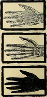 An illustration from The Roentgen rays in medicine and surgery as an aid in diagnosis and as a therapeutic agent : designed for the use of practitioners and students (1901)