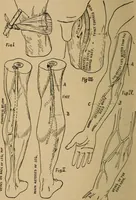 An illustration from Roper's questions and answers for stationary and marine engineers and electricians, with a chapter on what to do in case of accidents (1900)