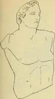 An illustration from Répertoire de la statuaire grecque et romaine (1908)