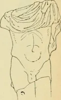 An illustration from Répertoire de la statuaire grecque et romaine (1908)