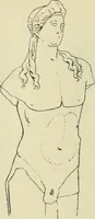 Picture 234 of 2223 from Répertoire de la statuaire grecque et romaine (1908), leaf 85