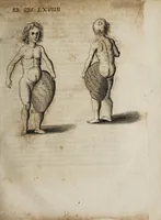 Picture 4 of 21 from Miscellanea curiosa medico-physica Academiæ Naturæ curiosorum, sive, Ephemeridum medico-physicarum Germanicarum curiosarum. 1672. (1672), leaf 161