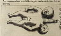 Picture 12 of 21 from Miscellanea curiosa medico-physica Academiæ Naturæ curiosorum, sive, Ephemeridum medico-physicarum Germanicarum curiosarum. 1672. (1672), leaf 480