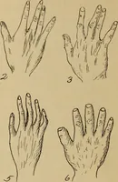 An illustration from The sage's key to character at sight; special student's course (1919)