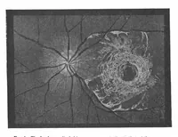An illustration from Scientific American, Vol. 100, No. 16 (April 1909) (1909)