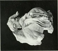 An illustration from Scopas et Praxitèle : la sculpture grecque au IVe siècle jusqu'au temps d'Alexandre (1907)