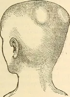 An illustration from The self-instructor in phrenology and physiology; with over one hundred new illustrations, including a chart for the use of practical phrenologists (1890)