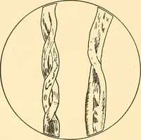 An illustration from Sewing and textiles; (1921)