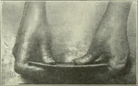An illustration from A shorter course in woodworking; a practical manual for home and school (1911)