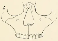 An illustration from Skeletal remains from Santa Barbara, California. : I. Craniology (1925)