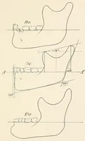 An illustration from Skeletal remains from Santa Barbara, California. : I. Craniology (1925)