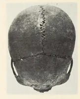 An illustration from Skeletal remains from Santa Barbara, California. : I. Craniology (1925)