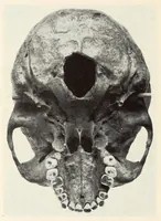 An illustration from Skeletal remains from Santa Barbara, California. : I. Craniology (1925)
