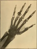An illustration from Something about X rays for everybody (1896)