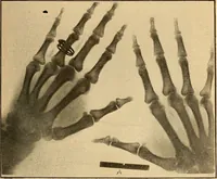 An illustration from Something about X rays for everybody (1896)