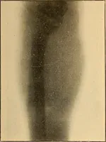 An illustration from Something about X rays for everybody (1896)