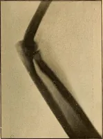 An illustration from Something about X rays for everybody (1896)