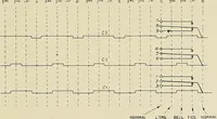 An illustration from Specifications for the multiplex printing telegraph system : theory and operation (1920)
