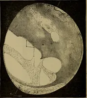 An illustration from Stars and telescopes; a hand-book of popular astronomy, founded on the 9th ed. of Lynn's Celestial motions (1899)