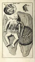 An illustration from Steph. Blancardi Anatomia reformata, sive, Concinna corporis humani dissectio, ad neotericorum mentem adornata ... : accedit ejusdem authoris De balsamatione nova methodus, à nemine antehac similiter descripta (1695)
