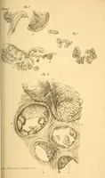 An illustration from The Stethoscope : a monthly journal of medicine and the collateral sciences (1854)