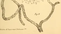 Picture 11 of 13 from The Stethoscope : a monthly journal of medicine and the collateral sciences (1854), leaf 807