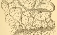 Picture 12 of 13 from The Stethoscope : a monthly journal of medicine and the collateral sciences (1854), leaf 807