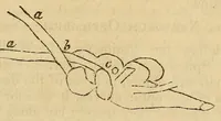 An illustration from The Stethoscope and Virginia medical gazette (1851)