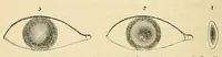 An illustration from The student's guide to diseases of the eye (1887)
