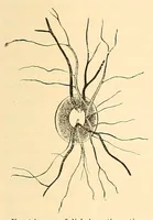 Picture 14 of 17 from The student's guide to diseases of the eye (1887), leaf 357