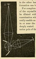 Picture 4 of 17 from The student's guide to diseases of the eye (1887), leaf 78