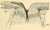 An illustration from The student's guide to diseases of the eye (1887)
