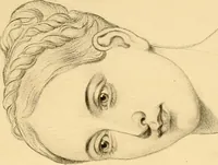 An illustration from The study of the human face (1865)