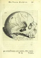 Picture 18 of 43 from Succenturiatus anatomicus : continens commentaria in Hippocratem : De capitis vulneribus : (1616), leaf 113