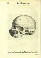 Picture 20 of 43 from Succenturiatus anatomicus : continens commentaria in Hippocratem : De capitis vulneribus : (1616), leaf 122