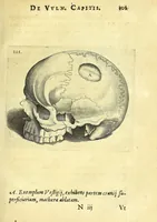 Picture 23 of 43 from Succenturiatus anatomicus : continens commentaria in Hippocratem : De capitis vulneribus : (1616), leaf 137