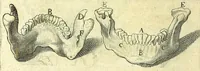 An illustration from Succenturiatus anatomicus : continens commentaria in Hippocratem : De capitis vulneribus : (1616)
