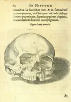 An illustration from Succenturiatus anatomicus : continens commentaria in Hippocratem : De capitis vulneribus : (1616)