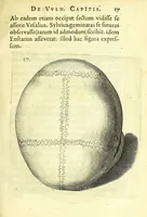 Picture 10 of 43 from Succenturiatus anatomicus : continens commentaria in Hippocratem : De capitis vulneribus : (1616), leaf 51