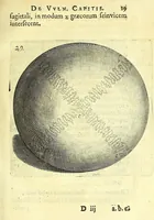 An illustration from Succenturiatus anatomicus : continens commentaria in Hippocratem : De capitis vulneribus : (1616)