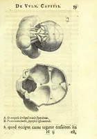 Picture 16 of 43 from Succenturiatus anatomicus : continens commentaria in Hippocratem : De capitis vulneribus : (1616), leaf 95