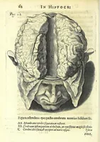 An illustration from Succenturiatus anatomicus : continens commentaria in Hippocratem : De capitis vulneribus : (1616)