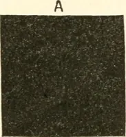 An illustration from Suggestion and psychotherapy (1912)